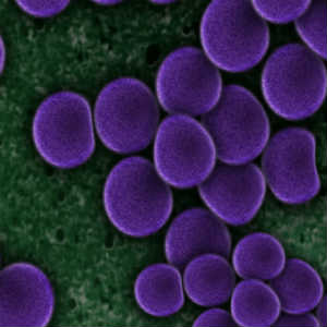 Bacterias de SARM